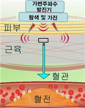 클린비 제품이미지